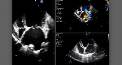 Review does not support use of ACEIs in dogs with preclinical MMVD